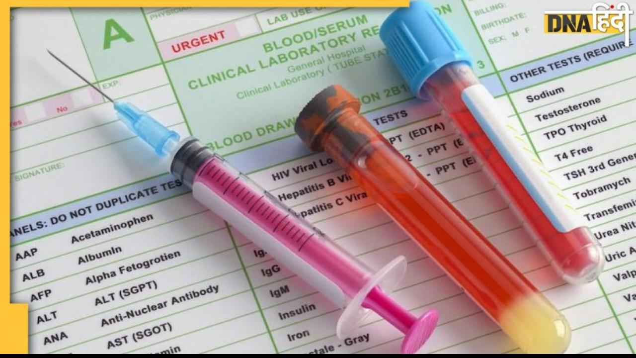 Blood Sugar Test: शुगर में फास्टिंग या पीपी टेस्ट नार्मल तो भी हो सकता है डायबिटीज, ये इंसुलिन टेस्ट देगा सटीक जानकारी
