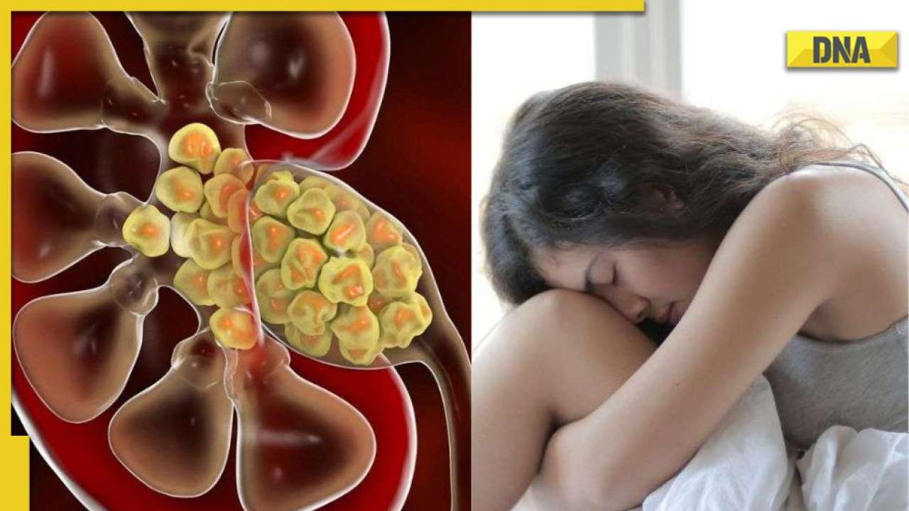 Kidney stones Immediately consult a doctor if you're experiencing