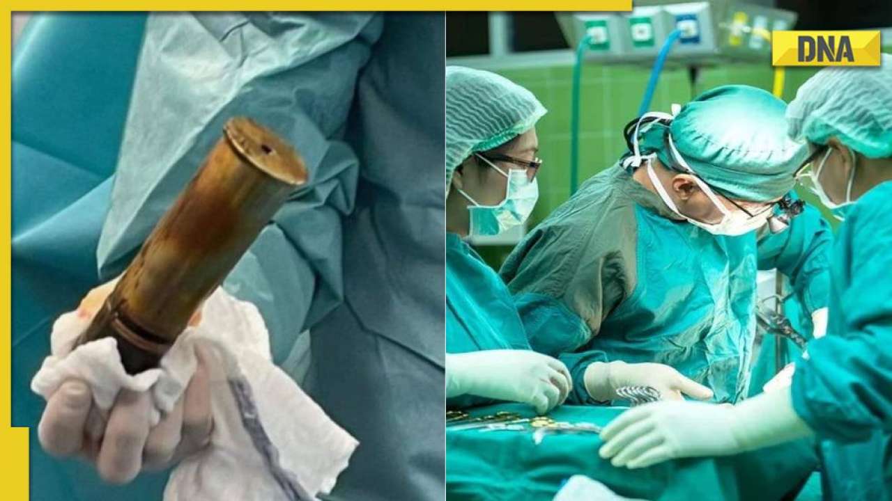 88yearold man arrives with bomb stuck in his rectum; hospital