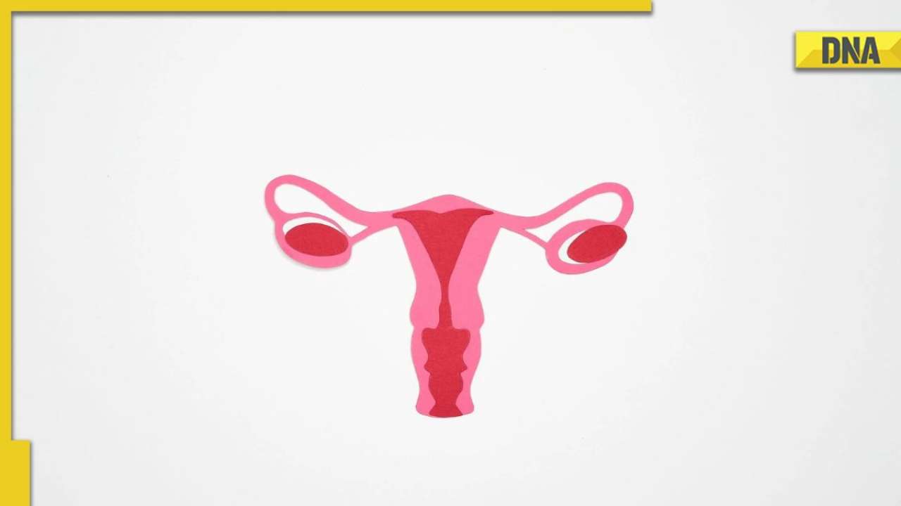 What are ovarian cysts? Symptoms and complications here