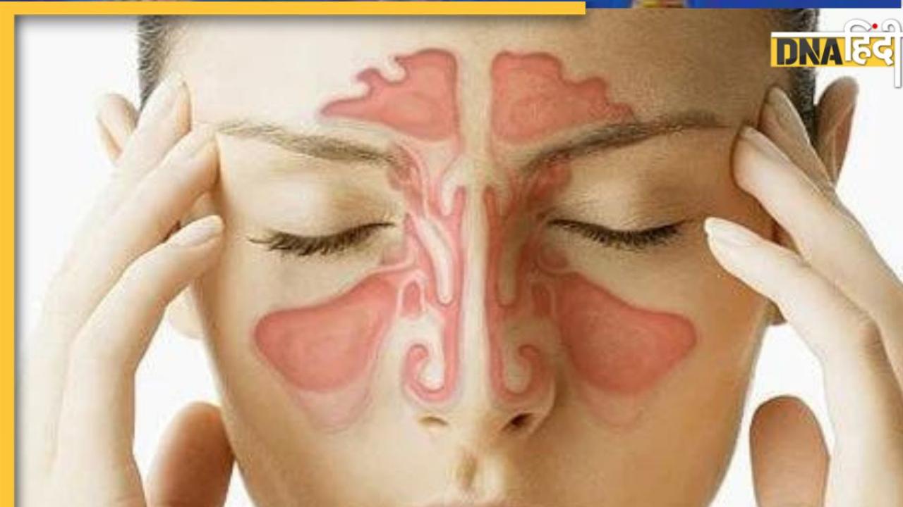 Sinus Remedies: साइनस से मिनटों छुटकारा दिलाएंगे ये नुस्खे, नाक और गले में जमा बलगम आ जाएगा बाहर
