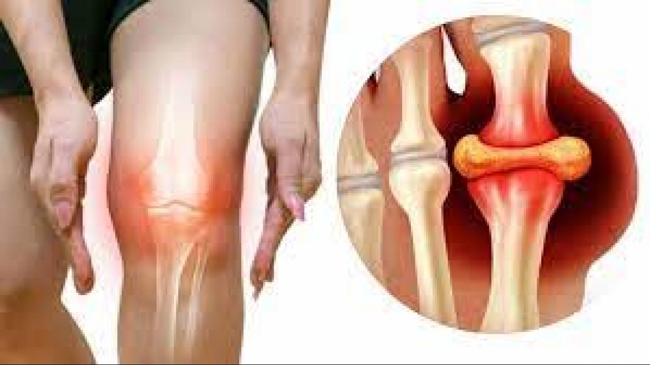 Arthritis Symptoms: पैर के अगूठे में दिख रहा ये संकेत बताता है शरीर में बढ़ रहा यूरिक एसिड, जान लें आर्थराइटिस के प्रारंभिक लक्षण