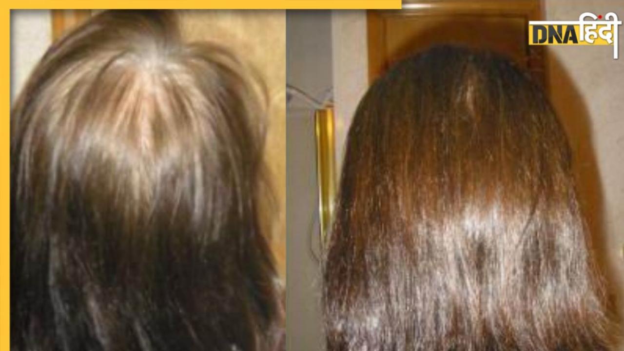Premature Grey Hair Treatment With Home Remedies For Grey Hair  Nykaas  Beauty Book