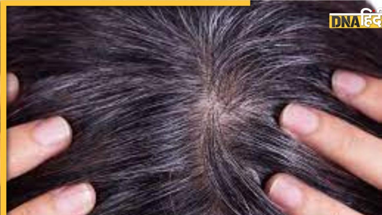 White Hair Remedy: सफेद बाल 1 घंटे में हो जाएंगे Black, बस हिना पाउडर में मिक्स कर लें ये 4 चीजें