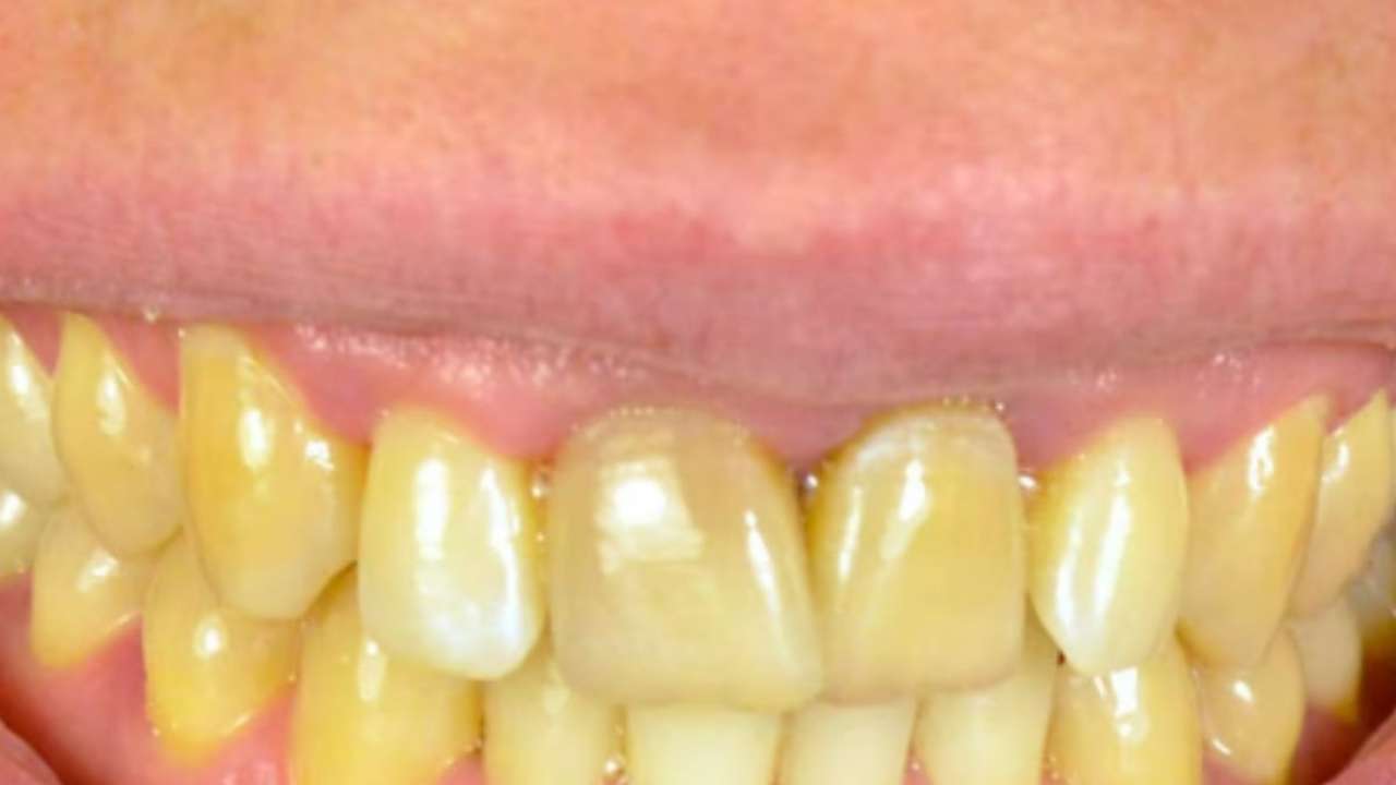 Chai lover? Here are 4 reasons why you should not have tea on empty stomach