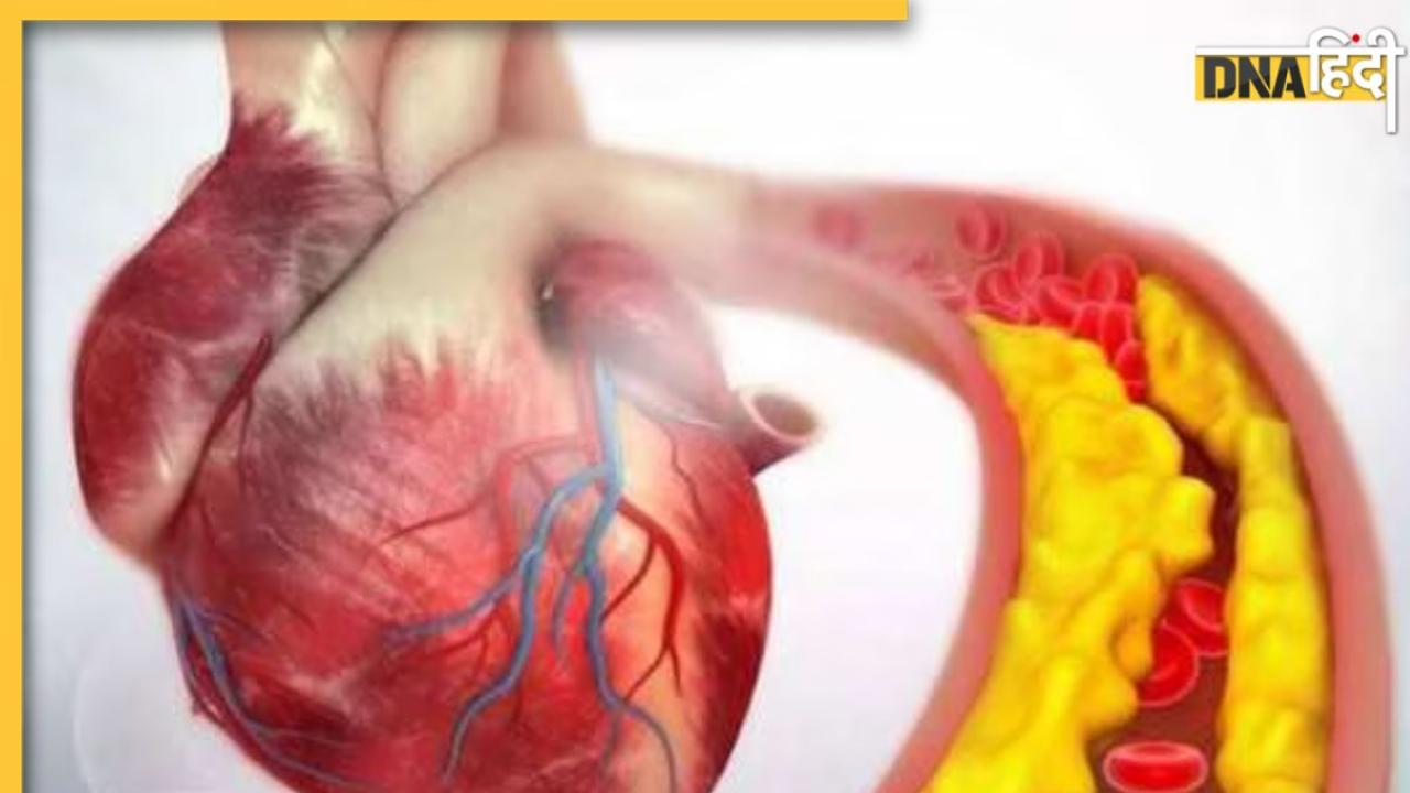 High Cholesterol में दवा का काम करते हैं ये 8 सुपरफूड्स, डाइट में शामिल करते ही ब्लड फैट होगा कम