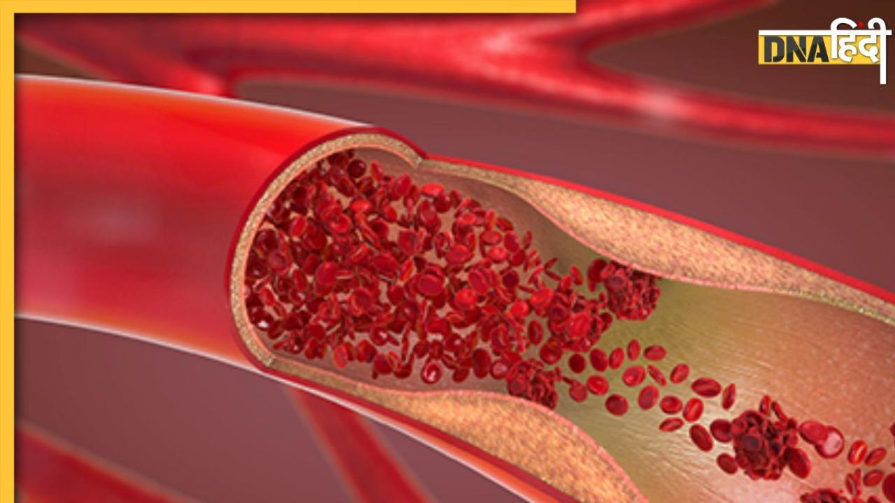 Yoga For Cholesterol: नसों में जमे गंदे कोलेस्ट्रॉल को बाहर निकाल देंगे ये 5 योगासन, जानें इनके फायदे