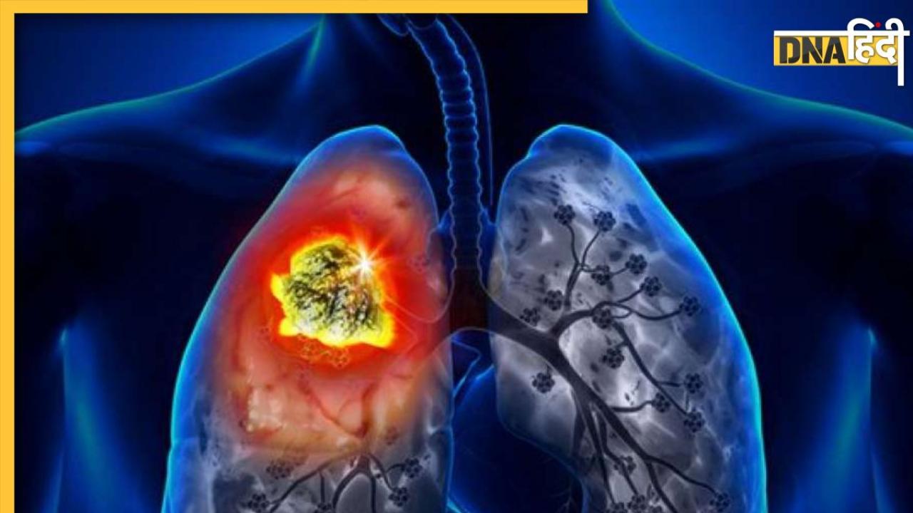 Lungs Cancer Symptoms: शरीर में दिखें ये 5 लक्षण तो तुरंत हो जाए सतर्क, लंग्स कैंसर के हो सकते हैं संकेत