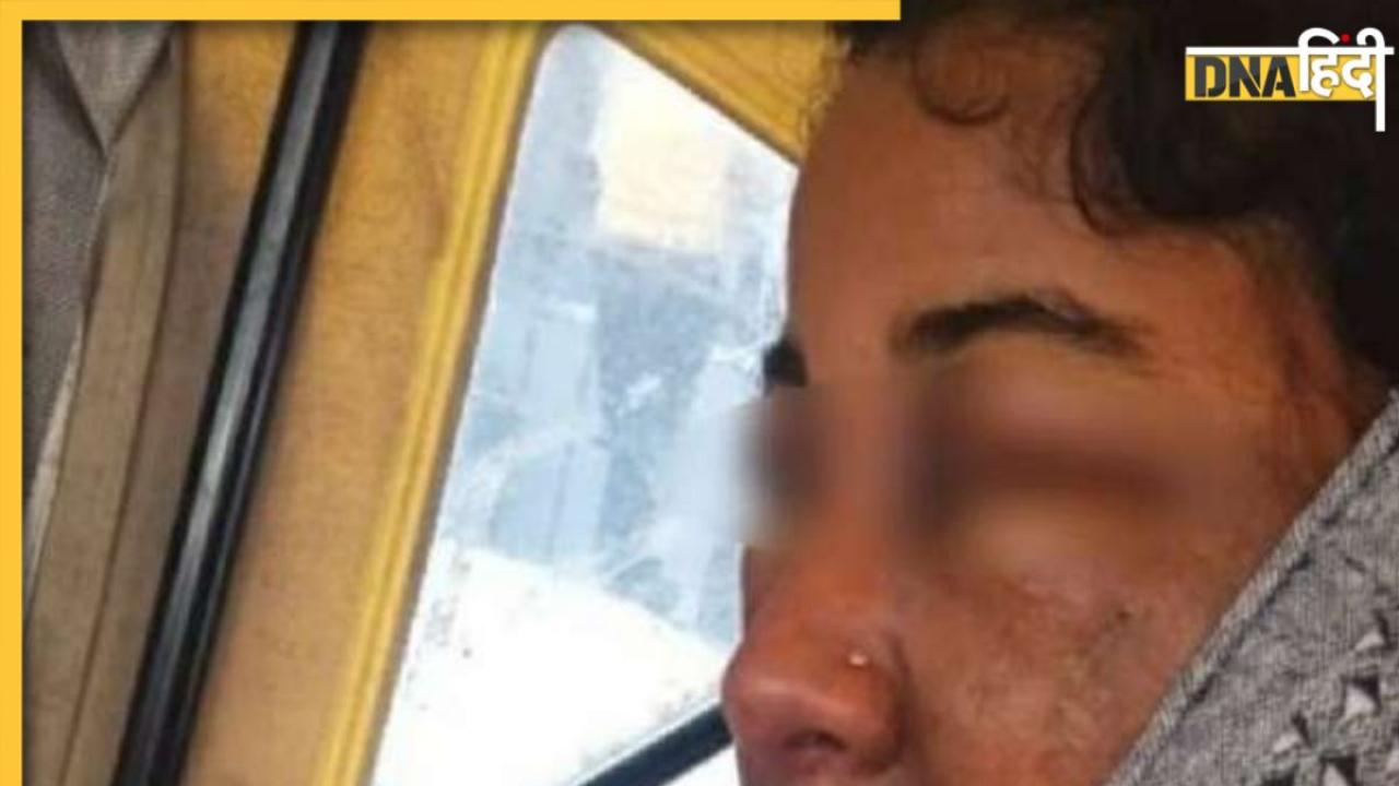 ब्यूटीशियन ने किया ऐसा मेकअप ICU पहुंच गई दुल्हन, खतरे में पड़ गई शादी
