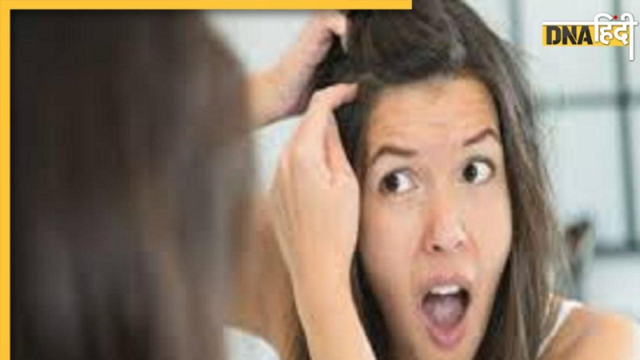 White Hair Remedy: कुछ ही घंटों में सफेद बालों को काला कर देगी घर में बनी हर्बल डाई, Gray hair भी हो जाएंगे Blackish-Brown