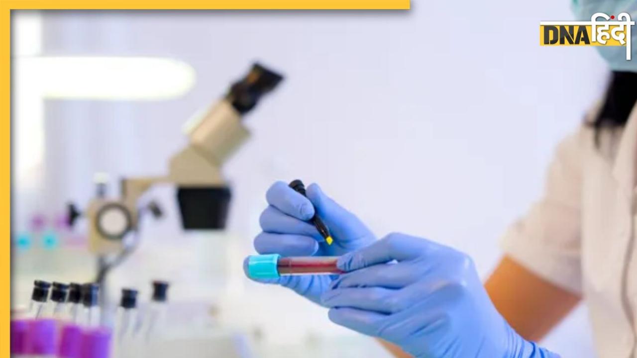 Blood Test: ये 4 ब्लड टेस्ट डायबिटीज से लेकर हार्ट अटैक तक की पहले ही दे देंगे जानकारी, समय रहते बच जाएगी जान