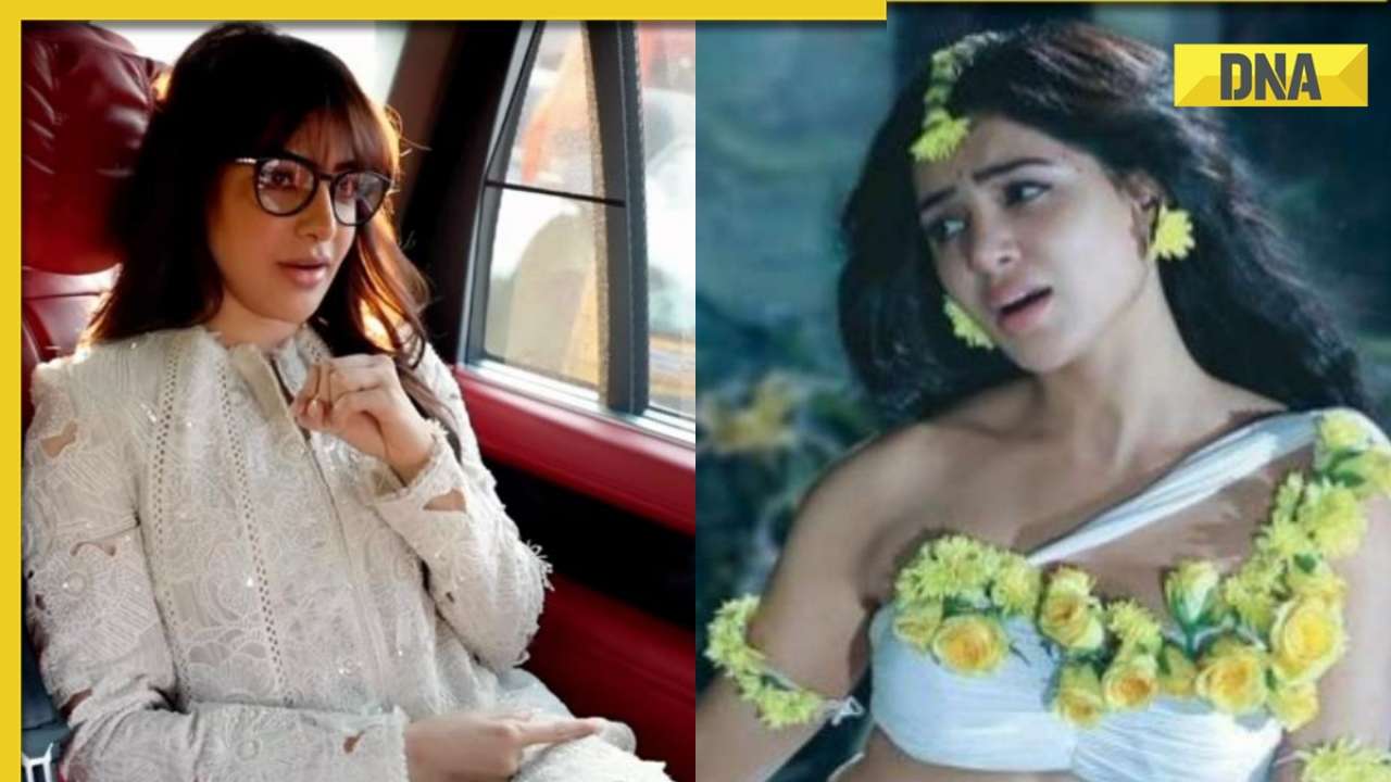Samantha Ruth Prabhu reveals she got bit by rabbit on Shaakuntalam sets, got imprint on arms from flower allergy