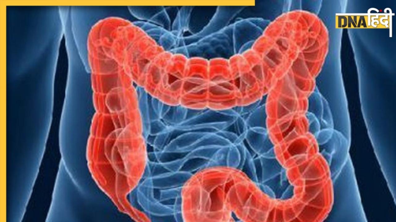 World Irritable Bowel Syndrome Day: हर समय पेट फूला या भारीपन महसूस होना आंतों के बीमार होने का है पहला संकेत
