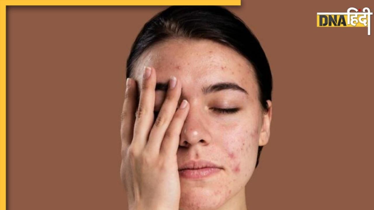 Skin Care Routine में कहीं आप भी तो नहीं करती हैं ये गलतियां? तुरंत कर लें सुधार वरना स्किन हो जाएगी डैमेज