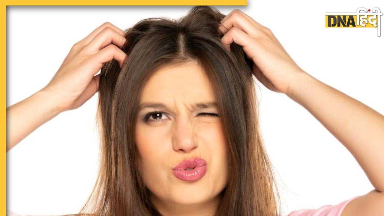 Scalp Itching Relief Tips: सिर में खुजली से हैं परेशान तो अपनाएं ये 3 घरेलू नुस्खें, दूर हो जाएगी पुरानी से पुरानी समस्या