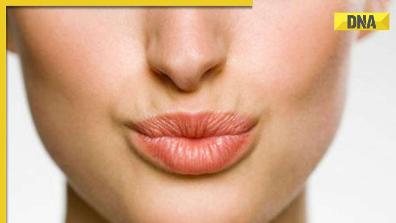 Sunburnt lips 5 tips to protect your lips from tanning in summer