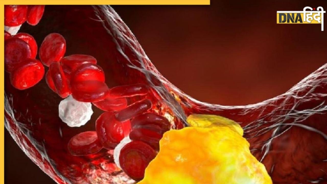 Cholesterol Sign: आंख-पैर-जीभ में दिखने लगे ये संकेत तो समझ लें ब्लड और नसों में बुरी तरह से जमने लगा है गंदा कोलेस्ट्रॉल 