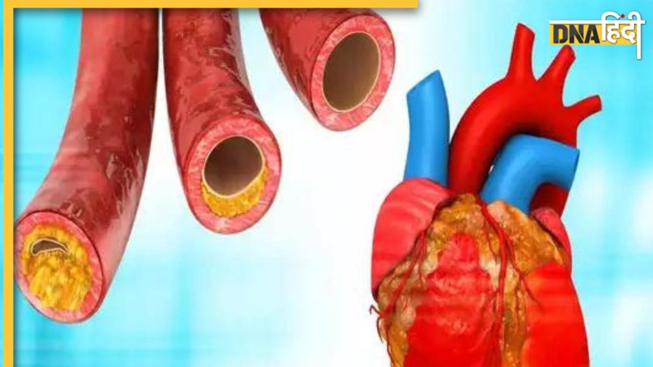 Cholesterol Remedy: धमनियों की दीवारों पर चिपके गंदे वसा पिघला देंगे ये 6 जूस, बिना दवा ही कम हो जाएगा हाई कोलेस्ट्रॉल 