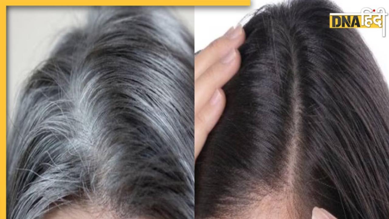 White Hair Remedy: सफेद बालों को हमेशा के लिए काला कर देंगे दादी-नानी के बताए ये नुस्खें, आज से ही करें इस्तेमाल