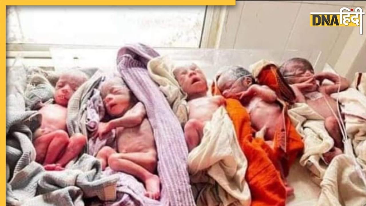Amazing News: यहां एकसाथ 5 बच्चों की मां बनी महिला, डॉक्टर भी देखकर रह गए हैरान