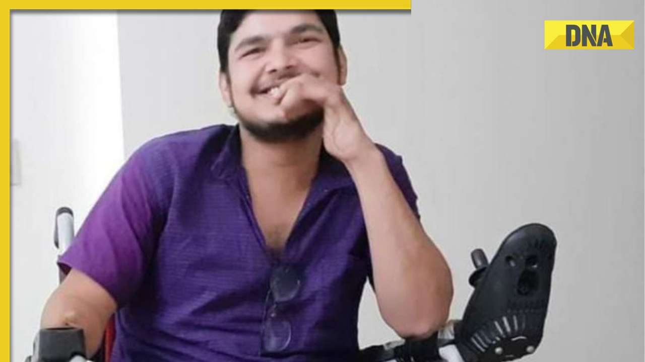 Meet Suraj Tiwari, Man Who Lost Both Legs, Right Arm In Accident Clears ...