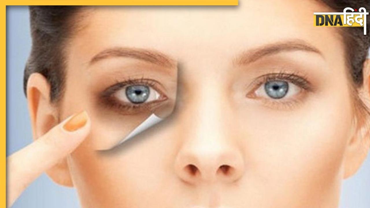 Dark Circles Removing Tips: आंखों के नीचे काले घेरों से हैं परेशान तो अपनाएं ये देसी नुस्खे, हमेशा के लिए खत्म हो जाएंगे डार्क सर्कल्स