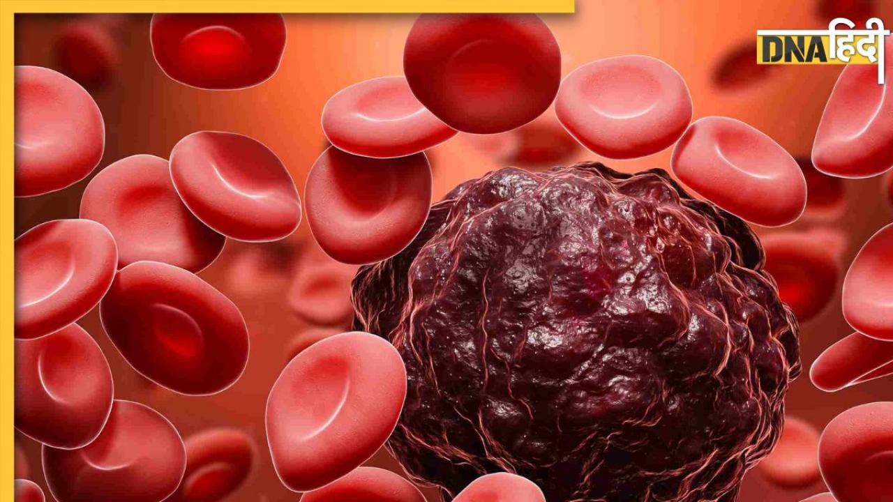 Blood Cancer Signs: शरीर में दिखने वाले इन लक्षणों को भूलकर भी न करें नजरअंदाज, हो सकते हैं ब्लड कैंसर का संकेत