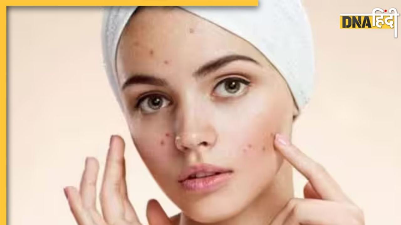 Scrub For Whiteheads: इन 3 होममेड स्क्रब से चुटकियों में गायब हो जाएंगे चेहरे और नाक के व्हाइटहेड्स, पहले जैसी चमक उठेगी स्किन