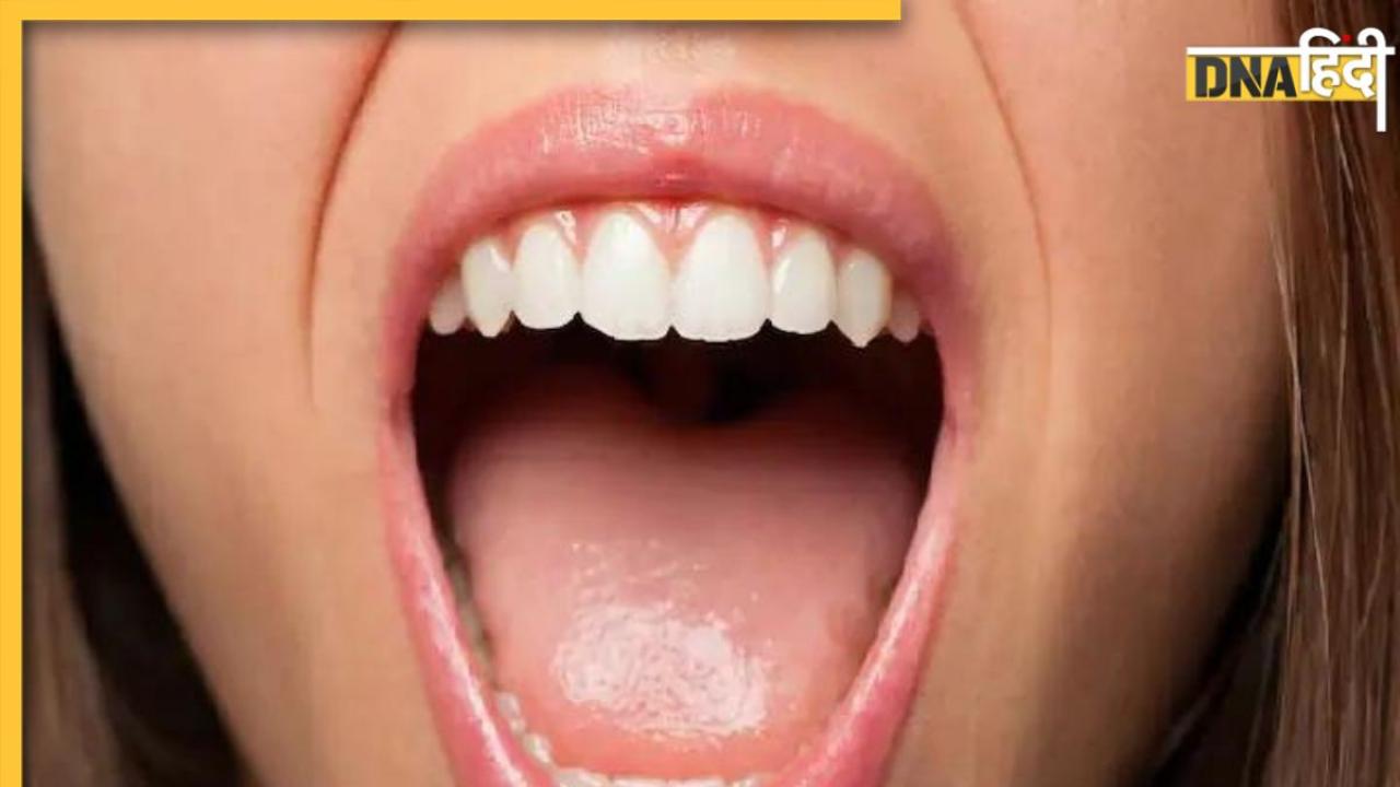 Mouth Cancer: मुंह में दिखने वाले ये निशान कैंसर का देते हैं संकेत, गुटका-सुर्ती छोड़ने का है ये रेड सिग्नल