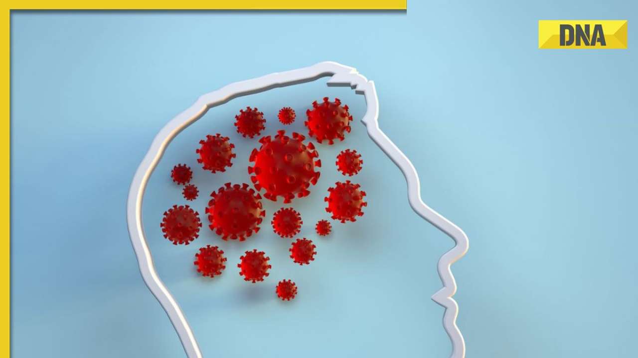 study-reveals-covid-19-virus-can-fuse-cells-leading-to-brain-fog-headaches