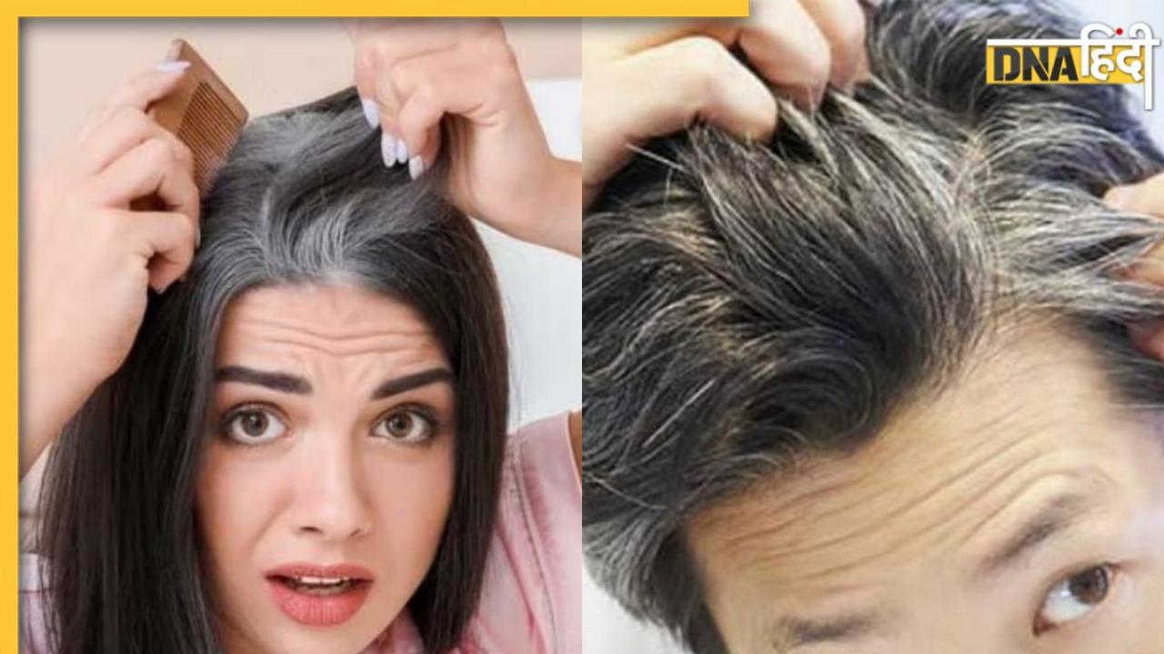 White Hair Remedy: जवानी में बाल होने लगे हैं सफेद तो घबराएं नहीं, इन देसी नुस्खों को आजमाने से दूर होगी समस्या