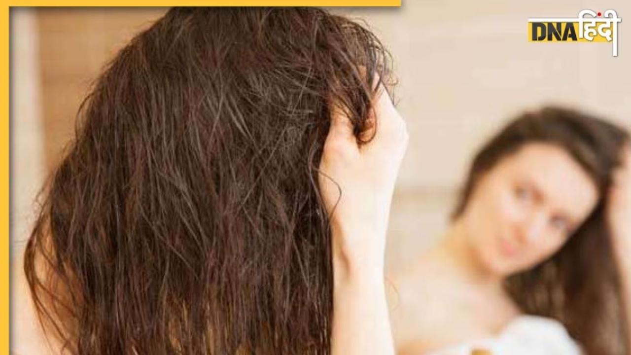 Hair Care Tips: बालों में लगाते हैं कैस्टर ऑयल तो भूलकर भी न करें ये गलती, वरना स्कैल्प में जलन के साथ होगा Hair Fall