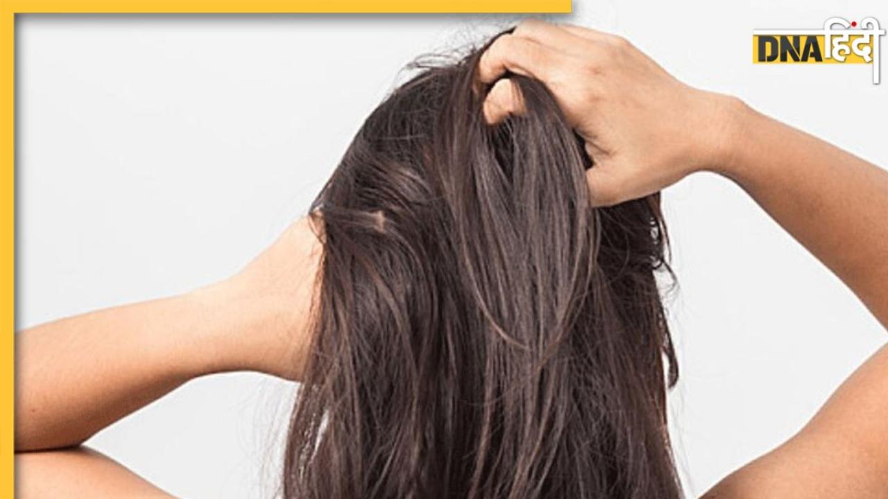 Hair Detox Benefits: इन 2 नेचुरल चीजों से करें हेयर डिटॉक्स, बालों की सारी गंदगी चुटकियों में होगी साफ 