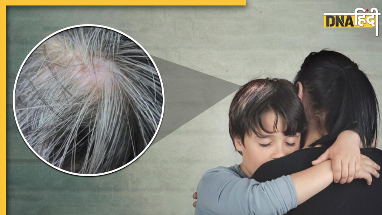 White Hair in Children: समय से पहले सफेद हो रहें हैं बच्चों के बाल, आजमाएं ये तरीके झट से काले होंगे बाल