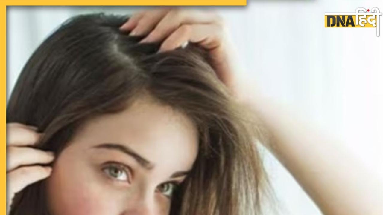 Details 77+ hair serum kya hota hai best ceg.edu.vn