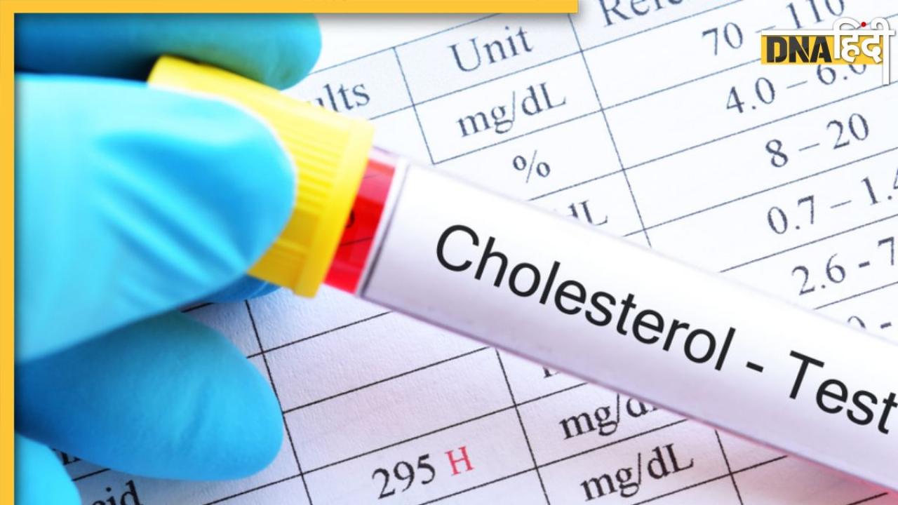Cholesterol Test: ये टेस्ट खोल देगा नसों में जमा बैड कोलेस्ट्राॅल का राज, हार्ट अटैक से बचने के लिए जरूर कराएं चेक