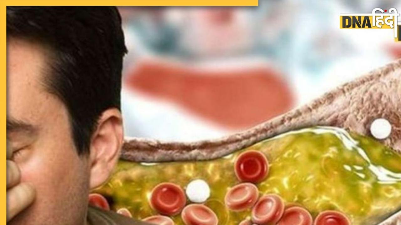 Cholesterol Remedy:नसों में भरी गंदगी साफ कर देंगी ये 5 चीज, हफ्ते में सिर्फ एक बार खाने से ही बाहर हो जाएगा बैड कोलेस्ट्राॅल
