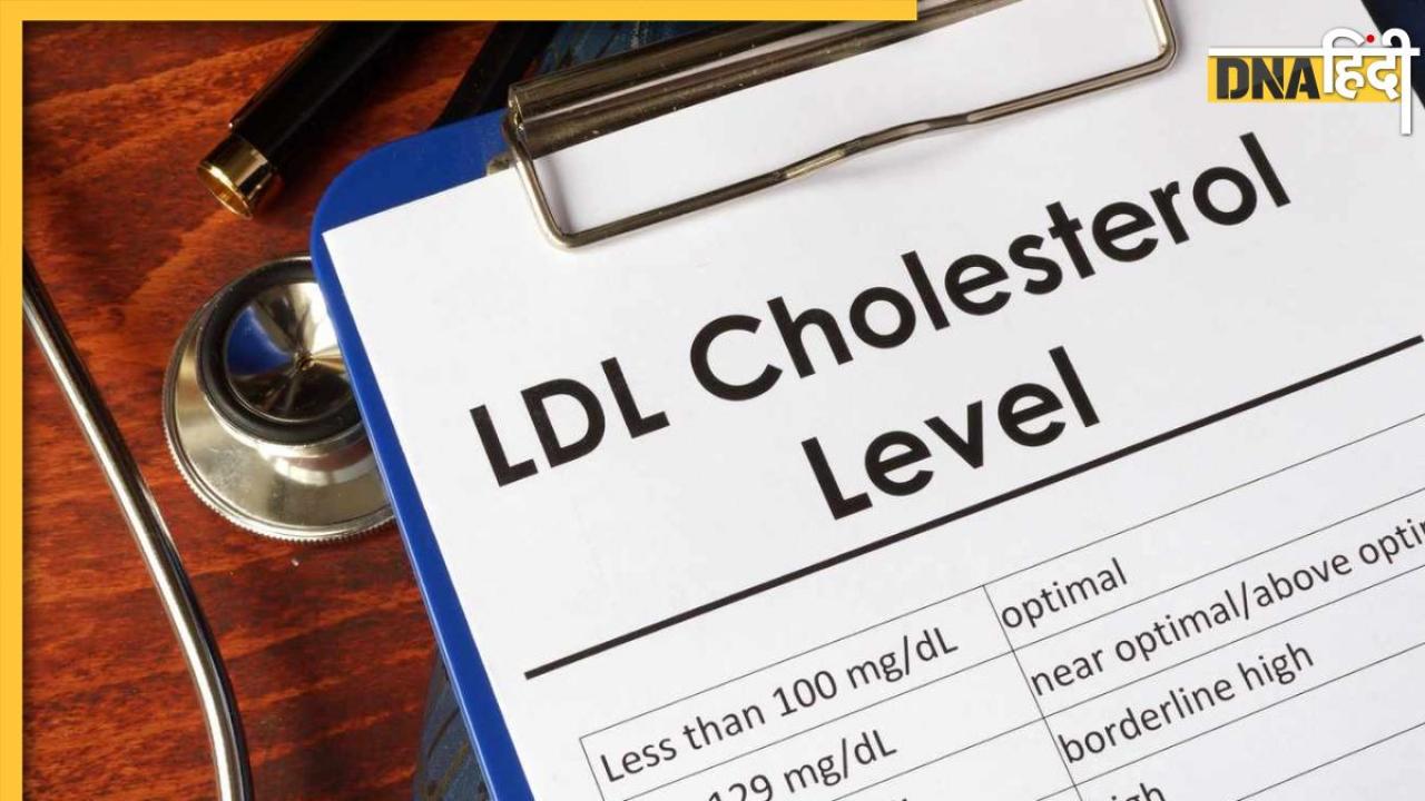 High Cholesterol Signs: मोटापा बढ़ने के साथ आ रहा है ज्यादा पसीना तो हो जाएं सावधान, इस जानलेवा बीमार के हैं ये 5 आखिरी संकेत