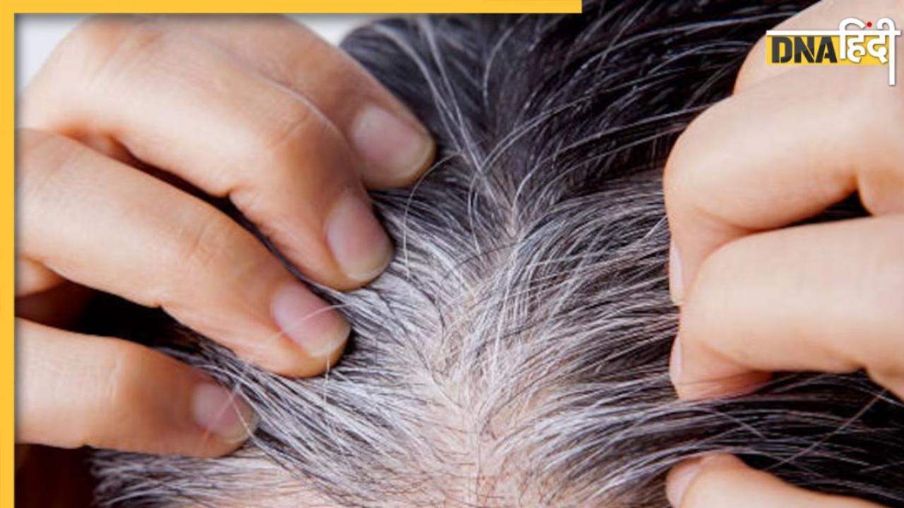 White Hair Remedies: कम उम्र में सफेद हो गए हैं बाल, इन आयुर्वेदिक उपायों से करें काला, टूटना और झड़ना भी हो जाएगा बंद