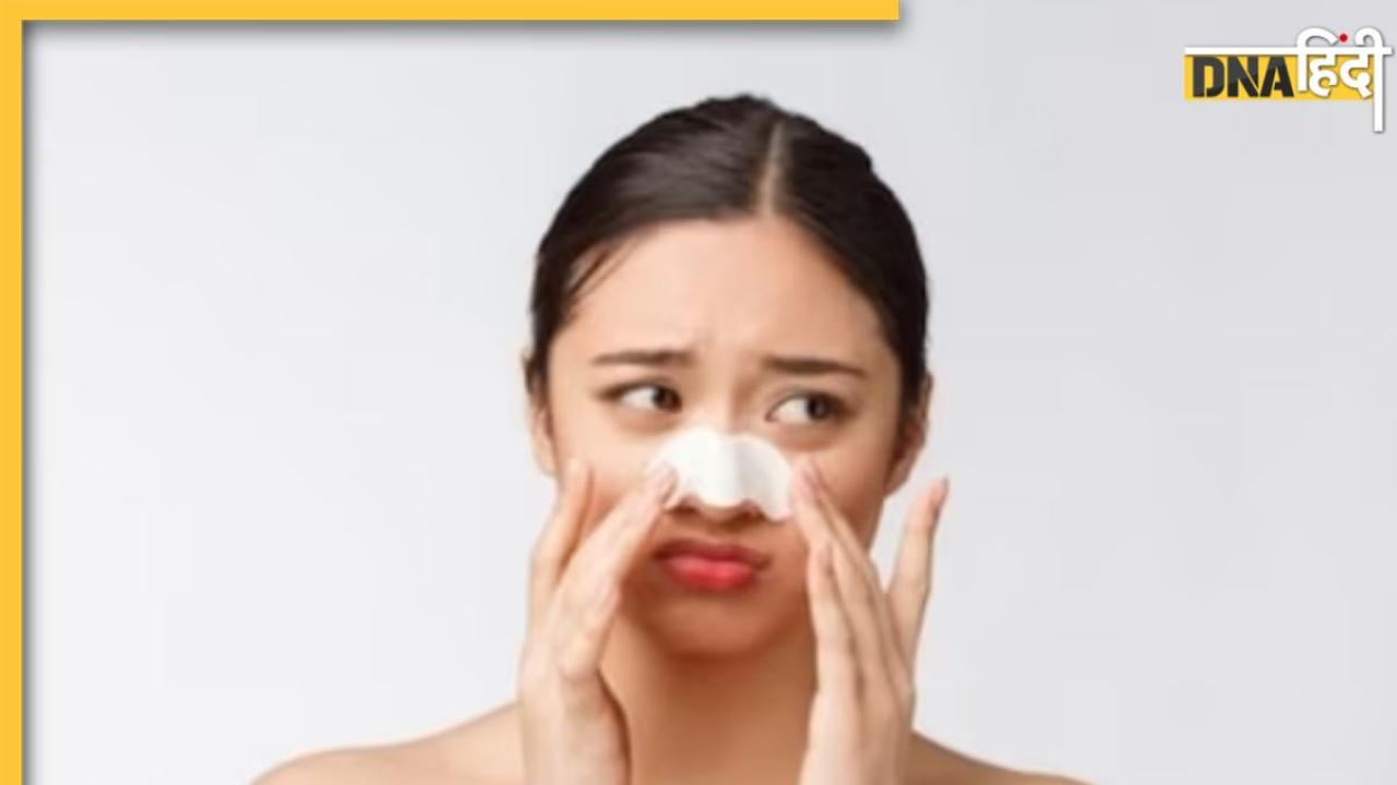 Blackheads Remover Tips: चेहरे की खूबसूरती छीन रहे हैं वाइट और ब्लैक हेड्स तो अपनाएं ये आसान उपाय, जड़ से खत्म होंगे काले धब्बे 