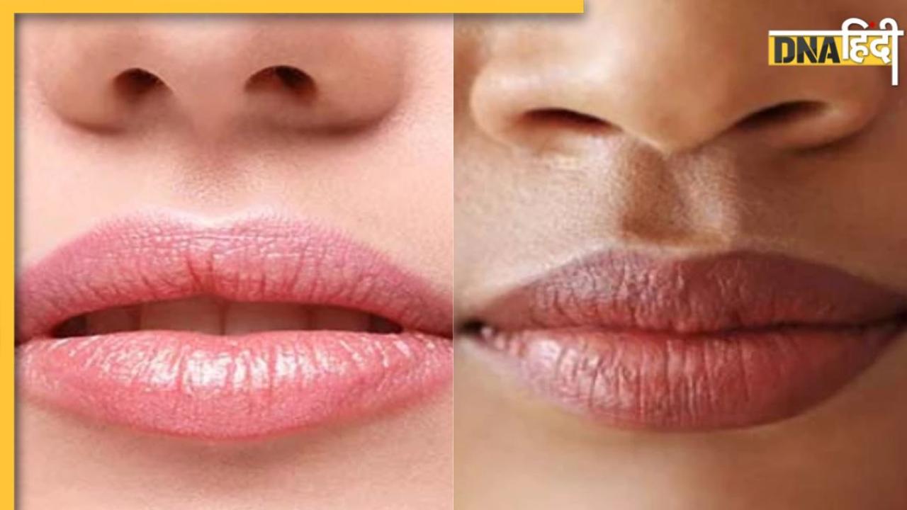 Dry Lips Causes: स्मोकिंग ही नहीं, होंठ काले होने के पीछे हैं ये 4 बड़ी वजह, न बरतें लापरवाही