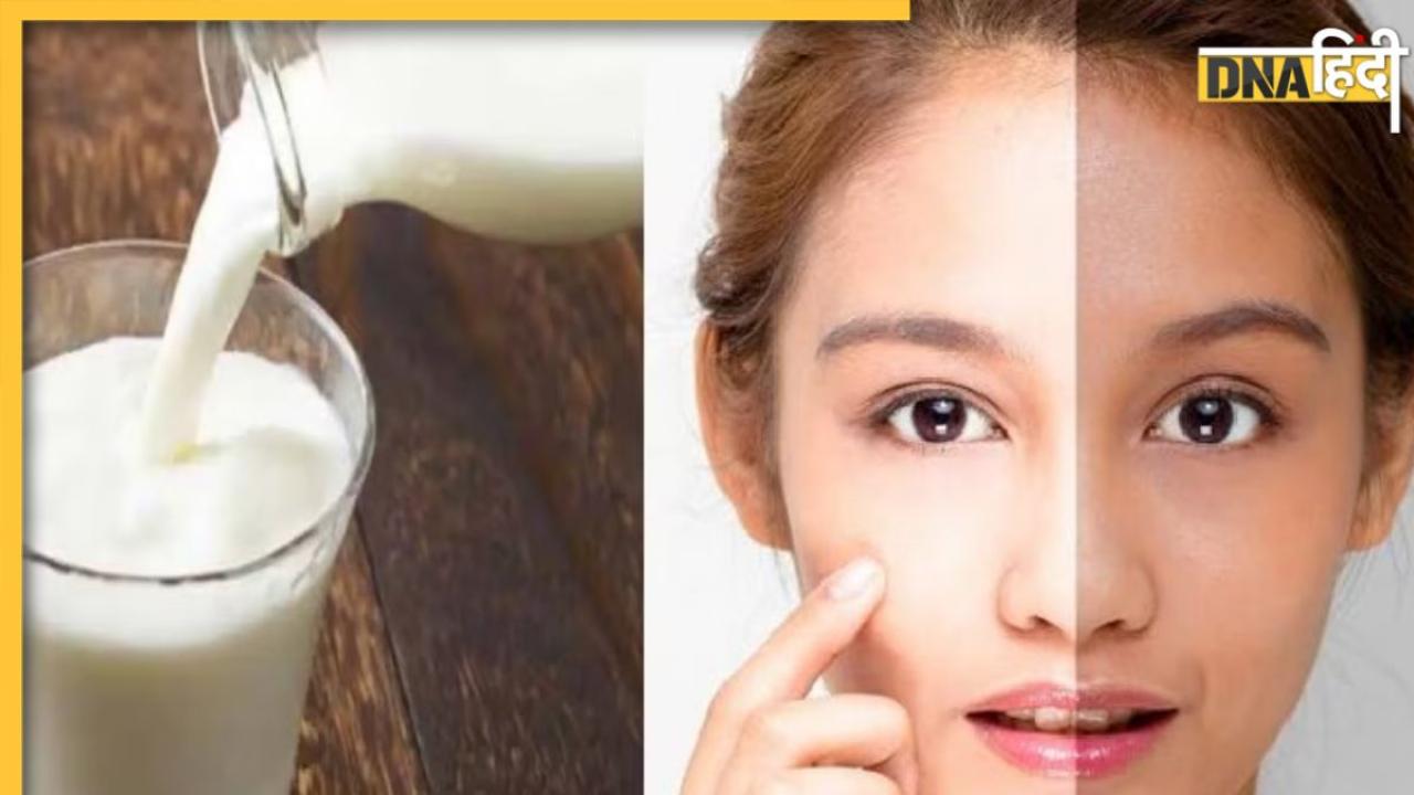 Raw Milk Benefits For Skin: फाइन लाइंस, झुर्रियों से हफ्ते भर में मिलेगा छुटकारा, इस तरह चेहरे पर लगाएं कच्चा दूध