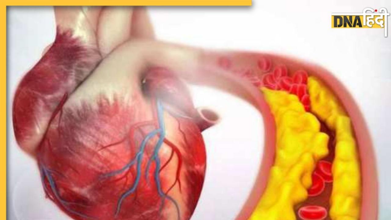 Cholesterol Remedy: शरीर में जमा कोलेस्ट्रॉल छानकर बाहर कर देंगी ये 8 चीजें, खुल जाएगी बॉडी की एक-एक नस  