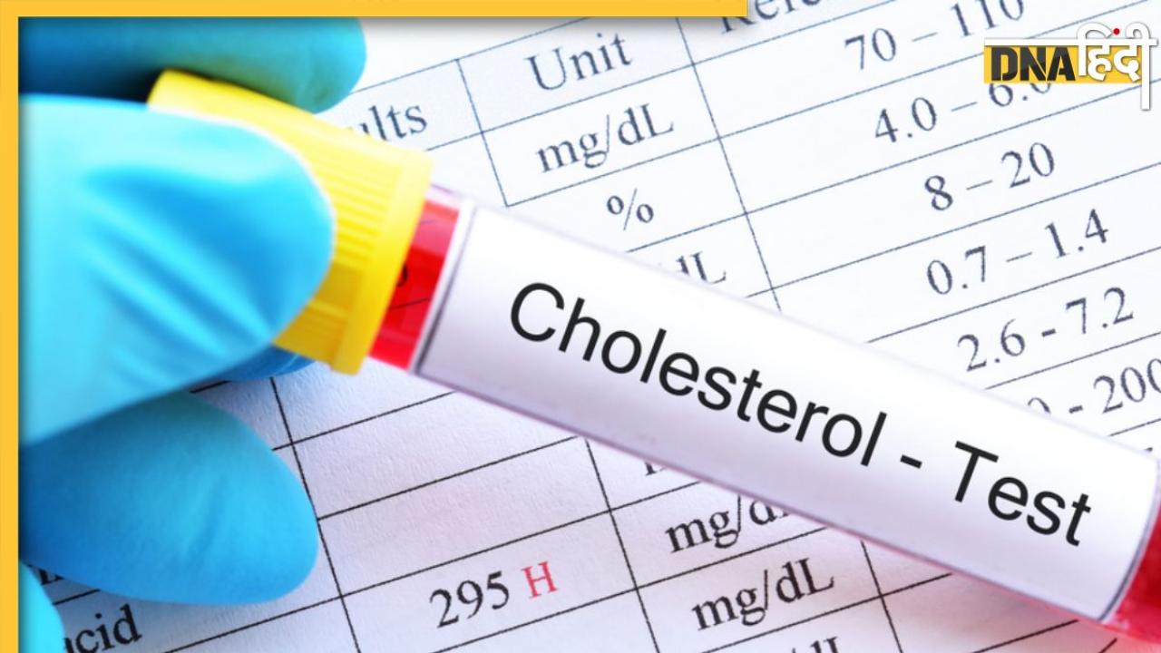Cholesterol Test: ये 4 लोग जरूर करा लें कोलेस्ट्रॉल टेस्ट, अनदेखी करने पर आ सकता है हार्ट अटैक