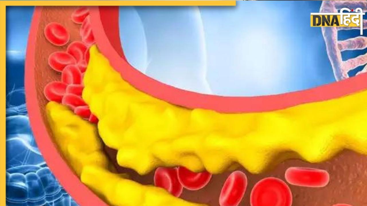 Cholesterol Lower Remedy: ये है कोलेस्ट्रॉल कम करने का सबसे तेज तरीका, ब्लॉक हो गई नसों का फैट बन जाएगा पानी