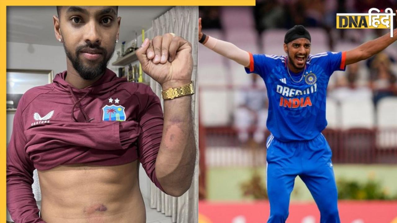 IND vs WI T20: Arshdeep Singh की गेंद ने Nicholas Pooran को दिया गहरा जख्म, देखें कैसा हुआ हाल