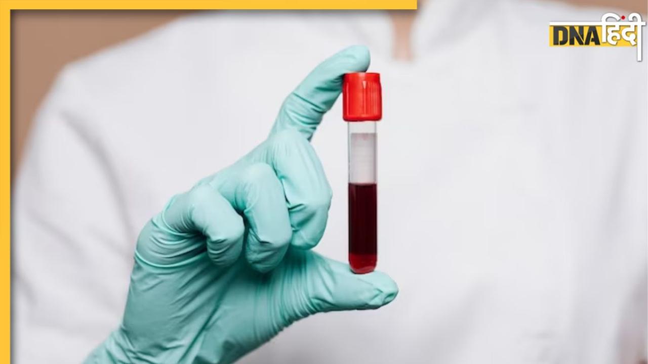 Blood Group Types Disease: इस ब्लड ग्रुप के लोगों को होता है हार्ट-अटैक का ज्यादा खतरा, इन्हें रहता है स्ट्रेस