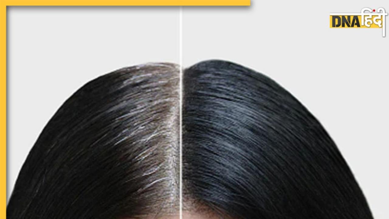 White Hair Remedy: हेयर कलर से नहीं, इन 5 उपायों को करने से परमानेंट काले होंगे बाल