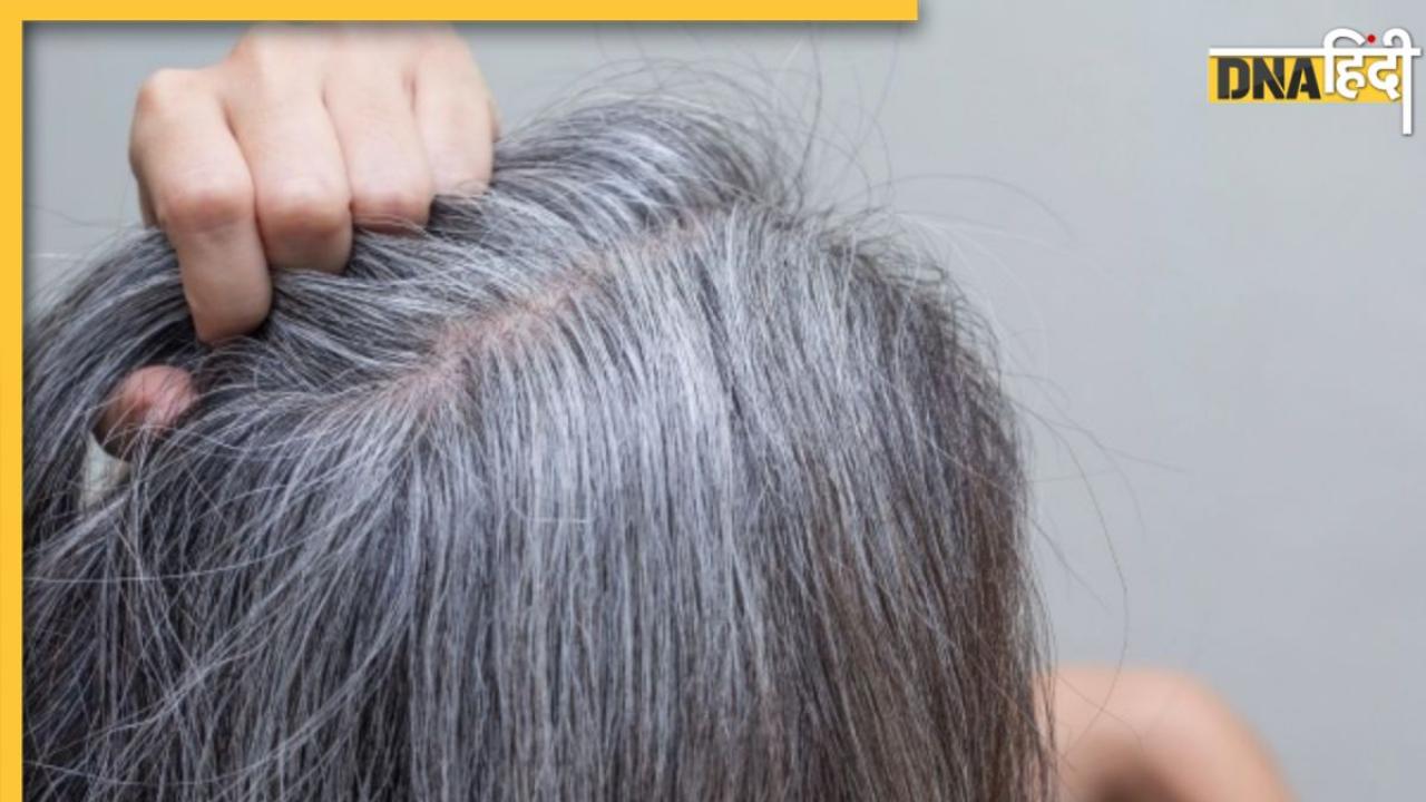 White Hair Prevention: कम उम्र में सफेद होने लगे हैं बाल तो डाइट में शामिल करें ये 10 फूड्स, मिलेग भरपूर पोषण