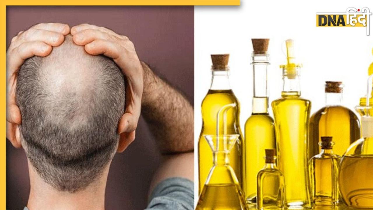 Hair Oil For Baldness: टूटते-झड़ते बालों से नजर आने लगा है गंजापन? ये 5 हेयर ऑयल लगाते ही दूर होगी समस्या  